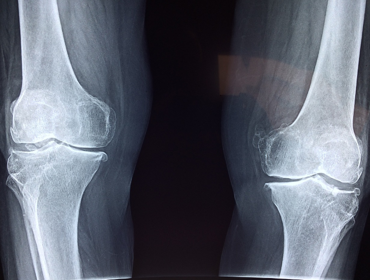 Approaches to Address Pain Beyond Painkillers